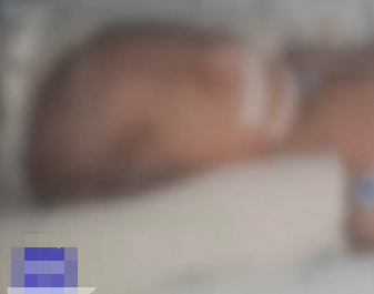 韩国一出生仅5天婴儿骨折昏迷不醒 护士涉嫌虐待