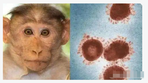 猴痘病毒是什么？意大利、瑞典发现确诊病例！